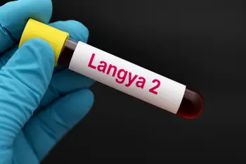 India Reports First Case of Langya 2 Virus in Kerala, Triggers Health Alert Langya 2 virus